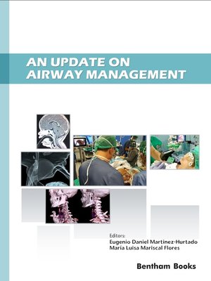 cover image of An Update on Airway Management
